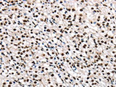 TALDO1 antibody