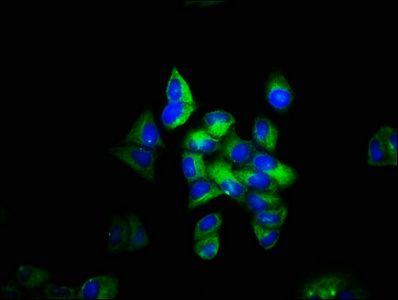 TLN1 Antibody