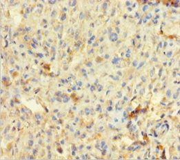 TLN1 Antibody