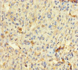 Talin-1 antibody