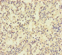 TLN1 Antibody