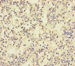 Talin-1 antibody