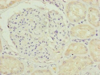 TAMM41 Antibody
