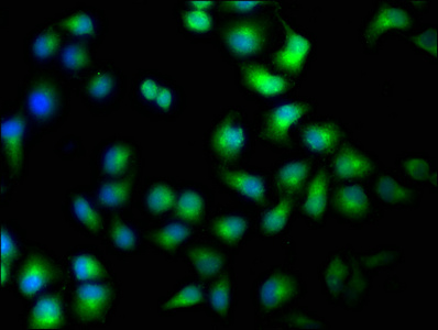 TAOK1 Antibody