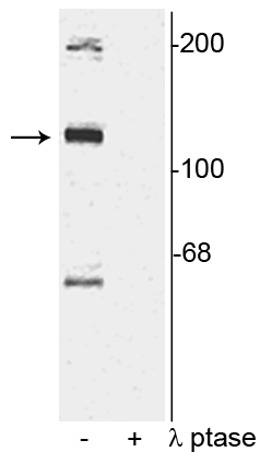 Anti-TAO2 (Ser181) Antibody