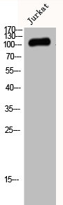 TAOK3 Antibody