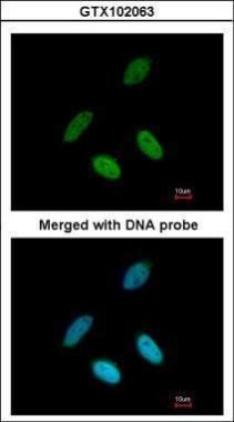 TAP Rabbit Polyclonal Antibody
