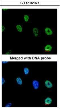 TAP Rabbit Polyclonal Antibody