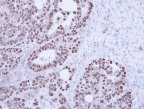 TAP Rabbit Polyclonal Antibody