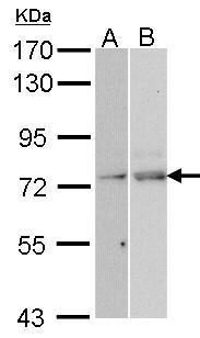 TAP Rabbit Polyclonal Antibody