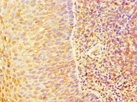 TAP1 Antibody