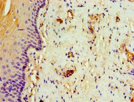 TAP1 Antibody