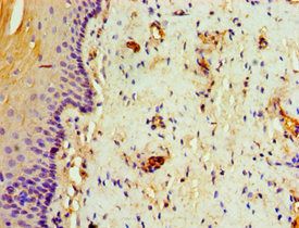 TAP1 antibody