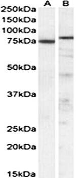 TAp63alpha/deltaNp63alpha Antibody