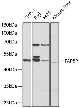 TAPBP antibody