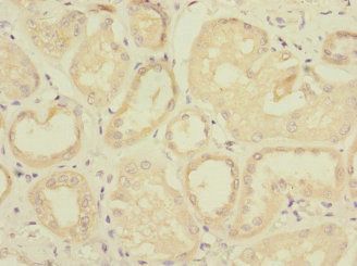 TAPBPL Antibody
