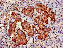 TARDBP Antibody