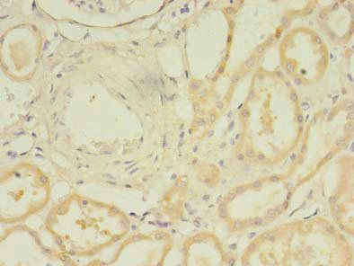 TARS2 Antibody