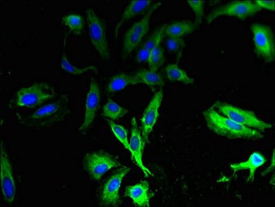 TAS2R13 antibody