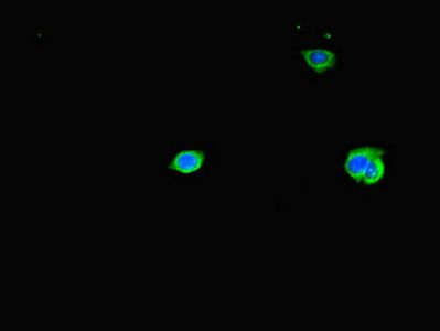 TAS2R38 antibody