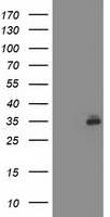 TASP1 Antibody