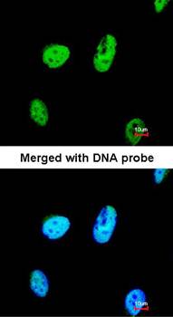 TATDN1 antibody