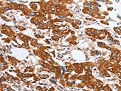 MAPT Antibody