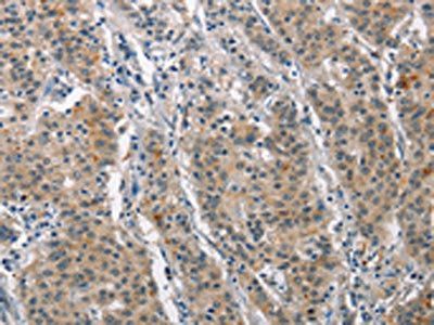 MAPT Antibody