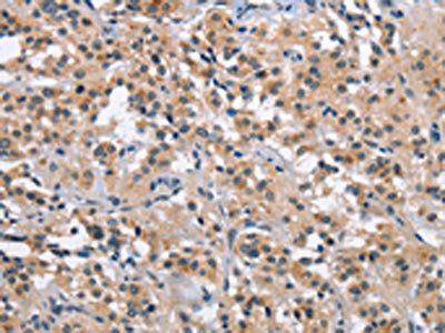 MAPT Antibody