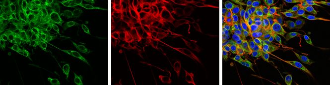 Tau Rabbit Polyclonal Antibody