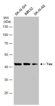 microtubule associated protein tau Antibody
