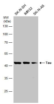 Tau Rabbit Polyclonal Antibody