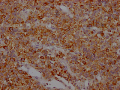 MAPT Recombinant Monoclonal Antibody