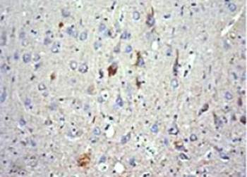 Phospho-Tau (thr 175) Rabbit Polyclonal Antibody