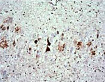 Phospho-Tau (thr 217) Rabbit Polyclonal Antibody