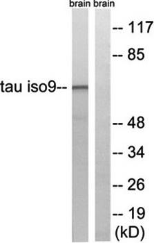 Tau (Ab-534/217) Antibody