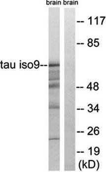 Tau (Ab-717/400) Antibody