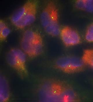 Tau (Ab-356) Antibody