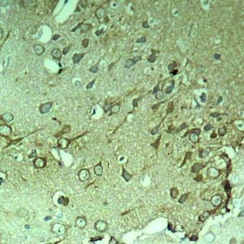 Tau (Ab-396) Antibody