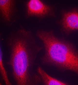 Tau (Ab-214) Antibody