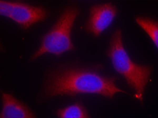 Tau (Phospho-Ser262) Antibody