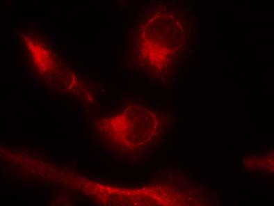 Tau (Phospho-Ser356) Antibody