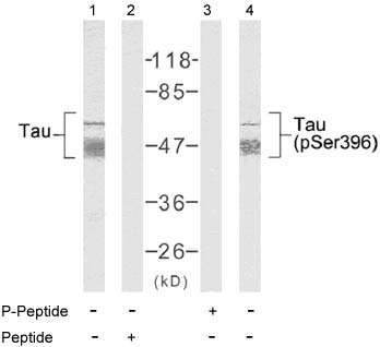 Tau (Phospho-Ser396) Antibody