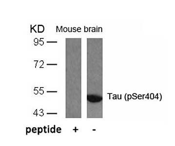 Tau (Phospho-Ser404) Antibody