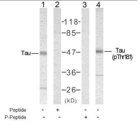 Tau (Phospho-Thr181) Antibody