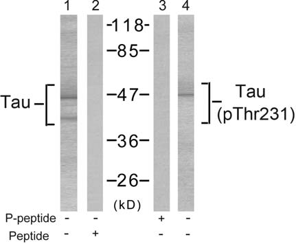 Tau (Phospho-Thr231) Antibody