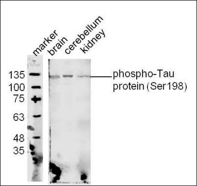 Tau protein (phospho-Ser198) antibody