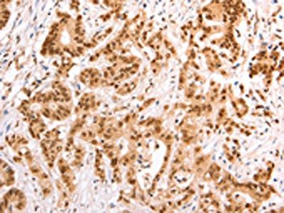 TAX1BP1 Antibody