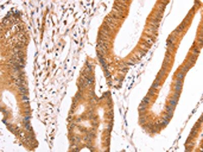 TAX1BP1 Antibody