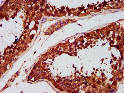 TBC1D1 Antibody